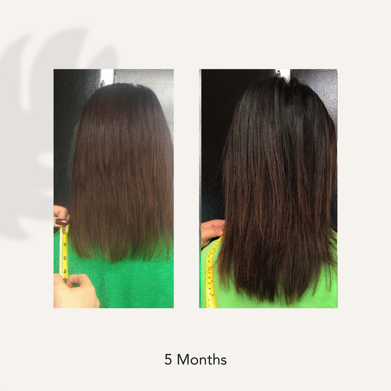5 months before and after photo showing increased hair health and length from using Actiiv Renew Healing Cleansing Treatment