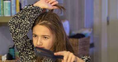 Why Is My Hair Shedding So Much?