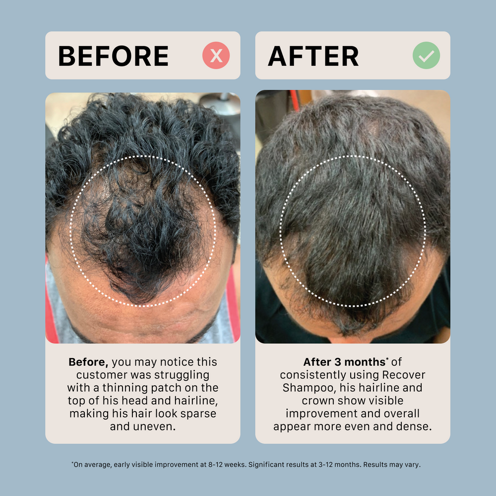 ACTIIV Recover thickening shampoo for men with lightweight conditioner duo in 16 oz salon size to support fuller, thicker-looking hair