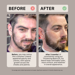 3 month Before and after comparison of a man's beard thickness with text about using a ACTIIV classic scented thickening beard oil.