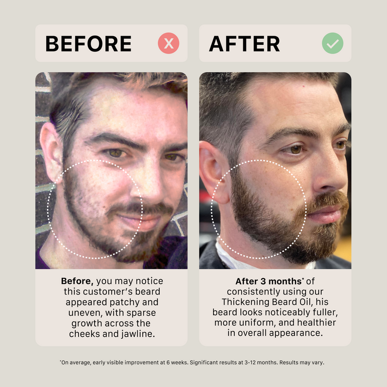 Before and after comparison of a man's beard with text about using ACTIIV Unscented thickening beard oil.