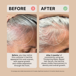 Before and after comparison of a person's hairline using a water-based hair serum.