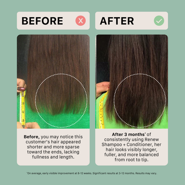 Before and after comparison of hair growth using Renew Shampoo + Conditioner on a person with green shirt.