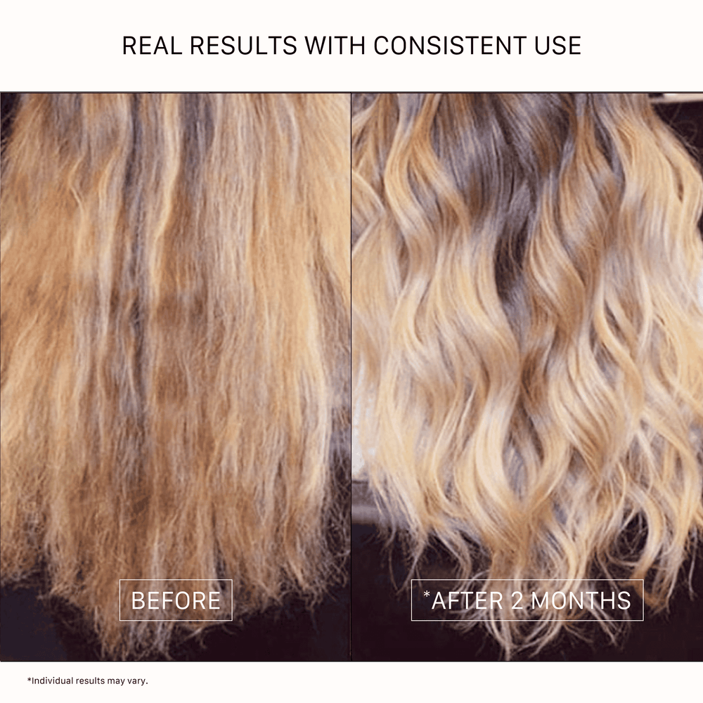 ACTIIV Renew healing shampoo and conditioner travel set for dry or damaged hair with plant-based nourishing formula