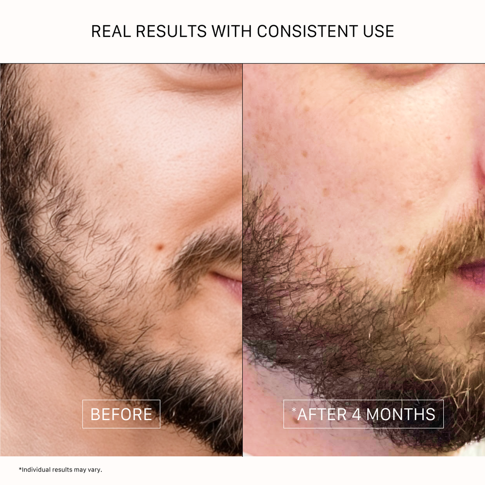 ACTIIV Thickening Beard Oil Unscented 1 oz plant-based beard conditioning oil for thicker fuller looking beard