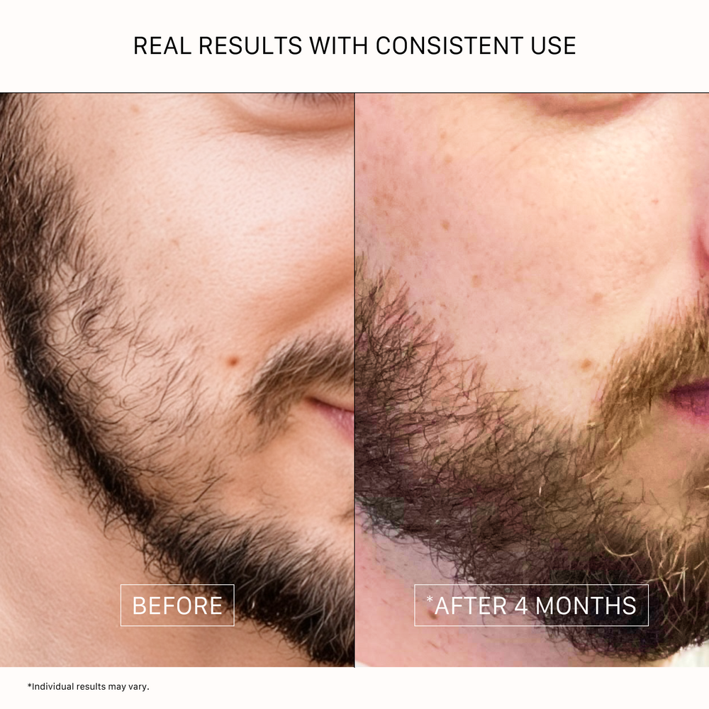 ACTIIV Thickening Beard Oil Classic 1 oz plant-based beard conditioning oil for thicker fuller beard appearance
