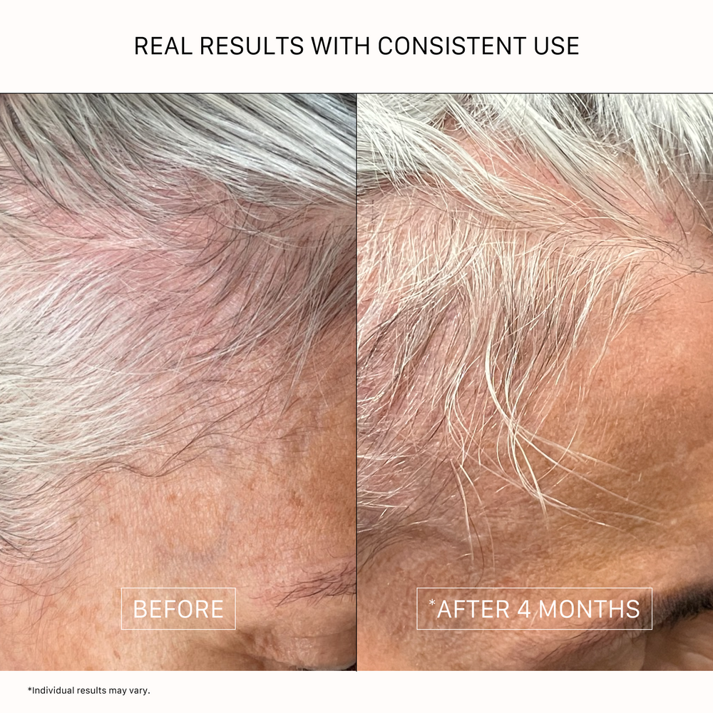 ACTIIV Thickening Hair Serum Oil-Based for Textured Hair 1.8 oz plant-based scalp and hair thickening serum.