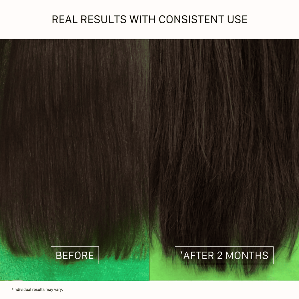ACTIIV Renew Healing Shampoo and Conditioner duo in mint green bottles on a clean neutral background, featuring plant-based hair care treatment packaging (7 fl oz), front-facing product image for scalp and hair health routine.