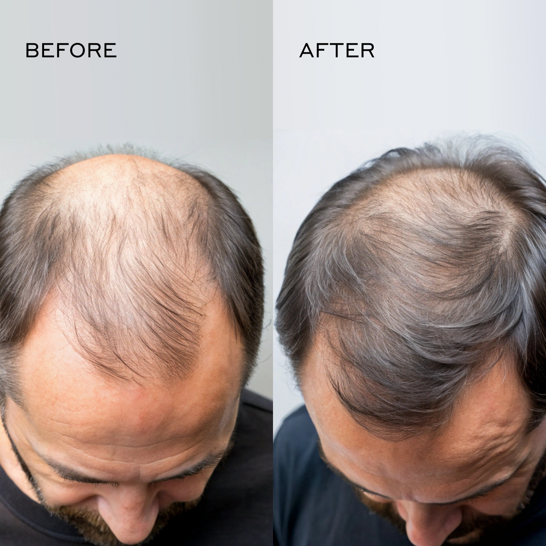 Before and after comparison showing thinning at the crown before use and a denser, more uniform-looking appearance