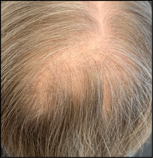 4-6 weeks