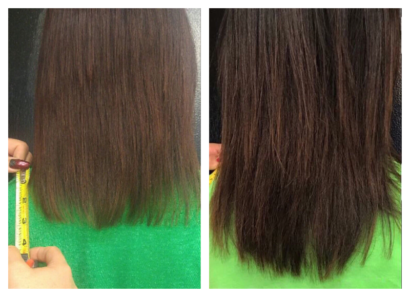Before and After showing faster hair growth and healthier hair after using Actiiv Renew Shampoo and Conditioner for 5 Months