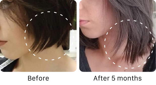 Before and after comparison of hair growth and length with dashed lines indicating the change.