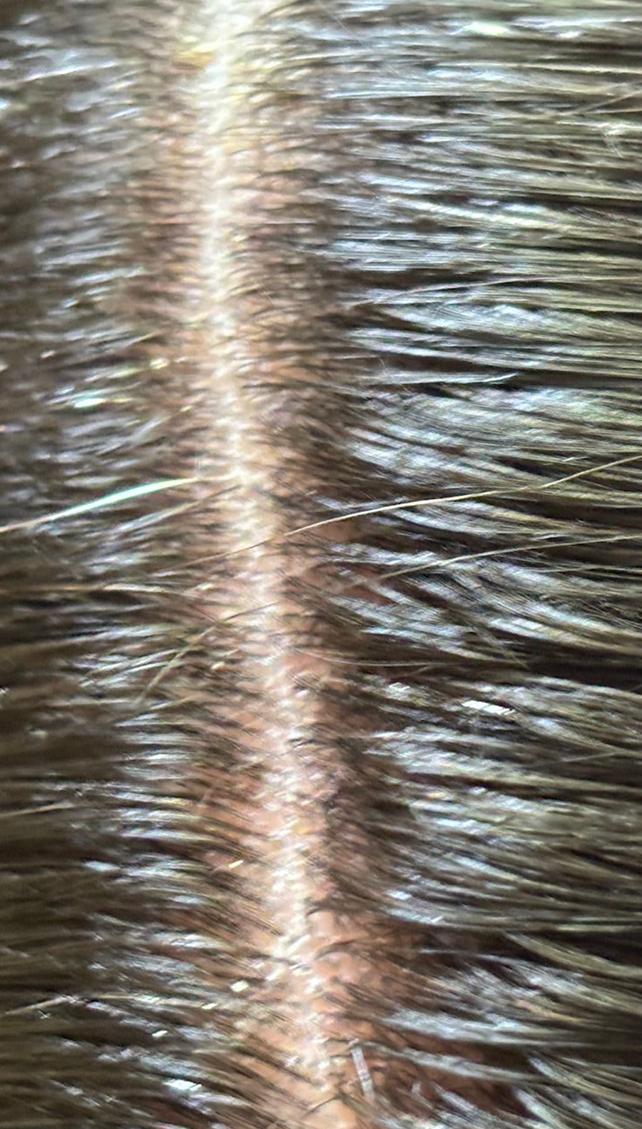 After photo - calmer, healthier-looking scalp