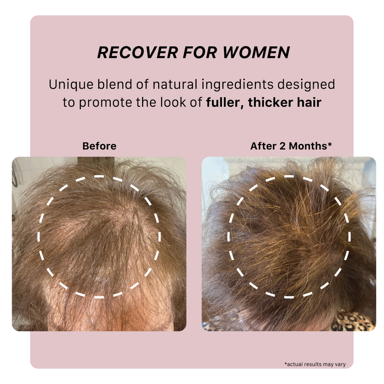 recover women results showing thicker fuller hair