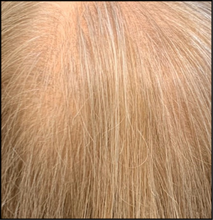 6-12 months