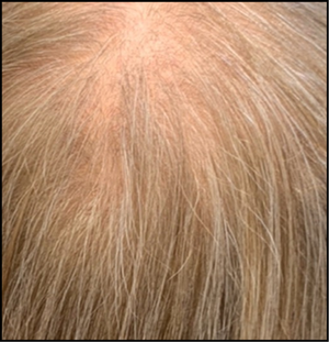 2-4 months