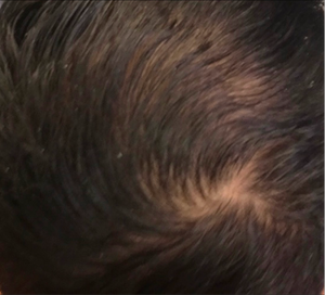 4-8 weeks